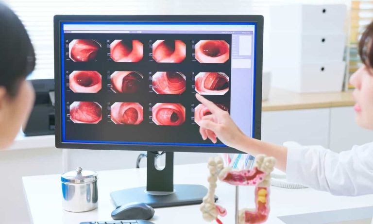 Understanding the Risks and Benefits of Colonoscopy Benefits of Colonoscopy