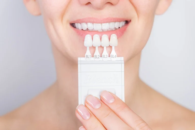 The Benefits of Veneers To Enhance Your Smile Benefits of Veneers To Enhance Your Smile