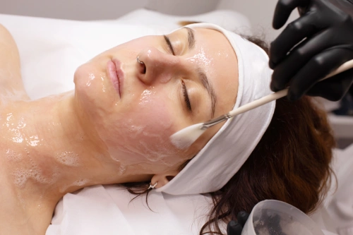 Chemical Peels for Aging Skin Chemical Peels for Aging Skin