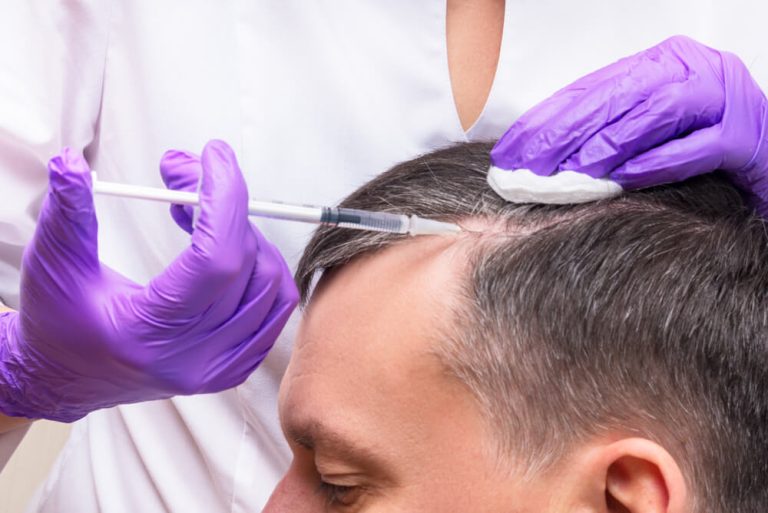 PRP Therapy for Hair Restoration PRP Therapy for Hair Restoration