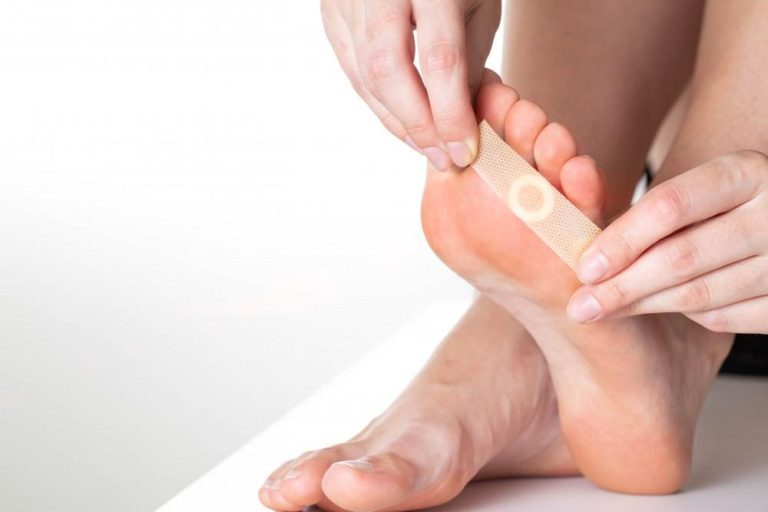 Exploring Treatment Options for Plantar Warts Treatment Options for Plantar Warts