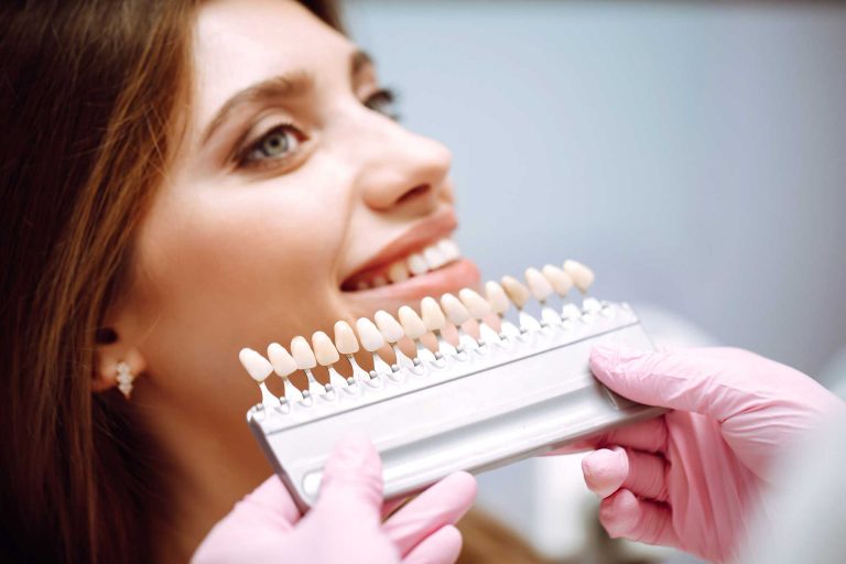 Role of Dental Aesthetics in Enhancing Your Smile